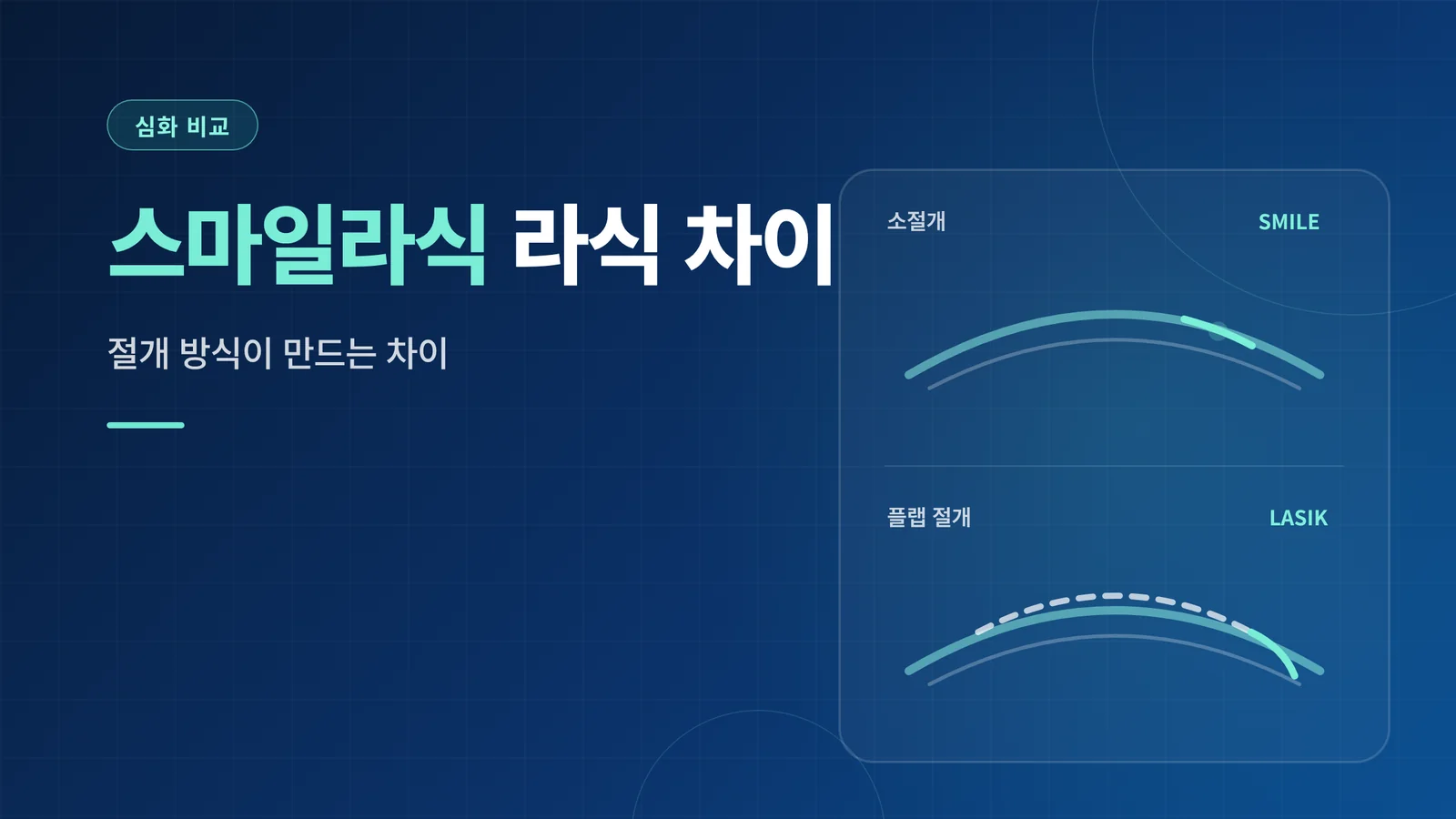 스마일라식 라식 차이
